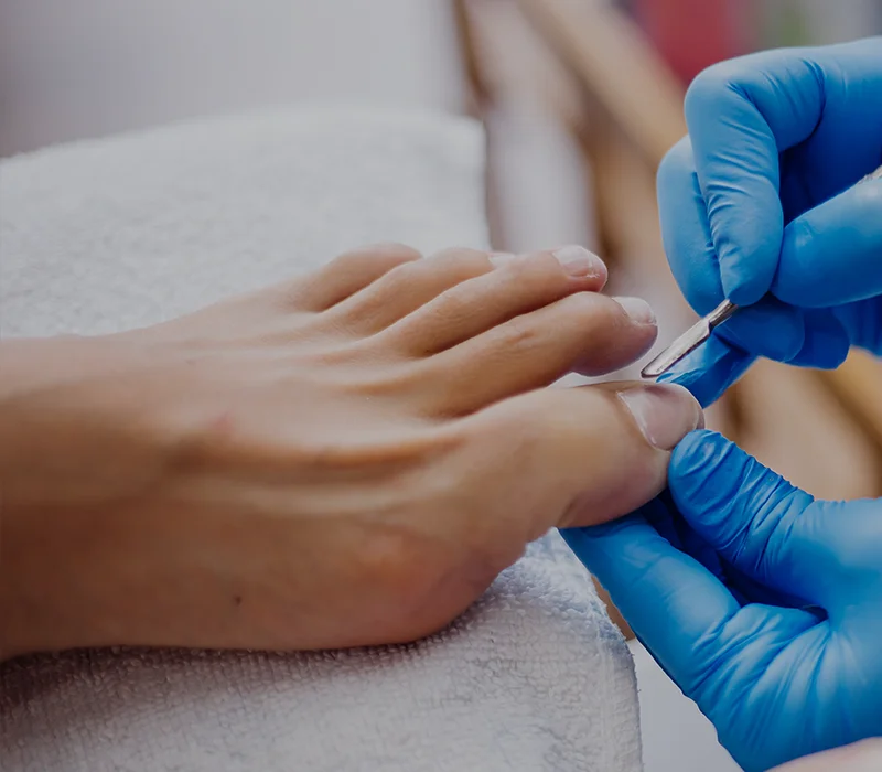 So-Feet pedicurepraktijk Thorn voetbehandeling